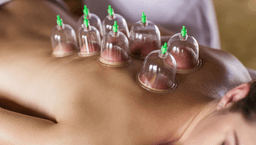 Image for Cupping therapy or sports cupping