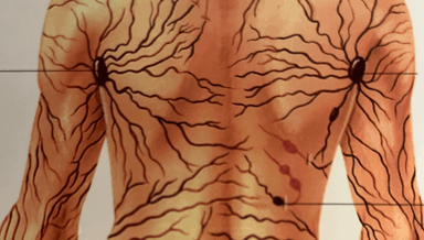 Image for Pre operative Manual Lymphatic drainage (cosmetic/orthopedic surgeries)